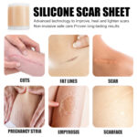 Self-Adhesive Silicone Scar Patch - Image 3
