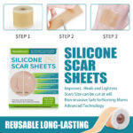 Self-Adhesive Silicone Scar Patch - Image 5