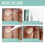 Onychomycosis Care Cleaning Brightening And Thickening Repair Pen-4ML - Image 5