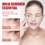 Under-Eye Essence for Milia Removal Brightening Anti-Puffiness Formula - Image 3