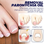 Nail Repair Oil Soothes & Strengthens Toenails - Image 3