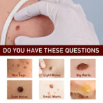 Skin Tag Wart Lightening Pen-3ML - Image 4