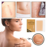 Waterproof Invisible Skin Concealer Patch - Image 3