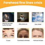 Forehead Wrinkle Patch Lifts And Smoothes Forehead Wrinkles Facial Skin Forehead Patch - Image 4