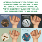 Ginger Nail Care Liquid Repair Hand And Foot Nail Care - Image 3