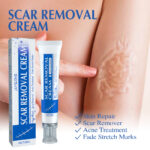 Scar-lightening Skin Repair Cream-30G - Image 3