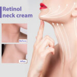 Retinol Neck Cream Lightens Neck Lines, Moisturizes And Firms Neck Skin, Neck Massage Cream - Image 4
