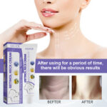 Retinol Neck Cream Lightens Neck Lines, Moisturizes And Firms Neck Skin, Neck Massage Cream - Image 3