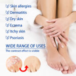 Skin Care Cream Moisturizing And Nourishing Skin Body Skin External Application Care Cream - Image 4