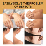 Waterproof Invisible Skin Concealer Patch - Image 4