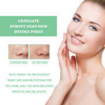 Herbal Exfoliating Gel Gently Cleans Closed Black Mouth And Shrinks Pores - Image 4