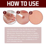 Skin Tag Wart Lightening Pen-3ML - Image 5