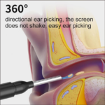 Ear Wax Otoscope With Camera-Black - Image 3