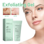 Herbal Exfoliating Gel Gently Cleans Closed Black Mouth And Shrinks Pores - Image 2